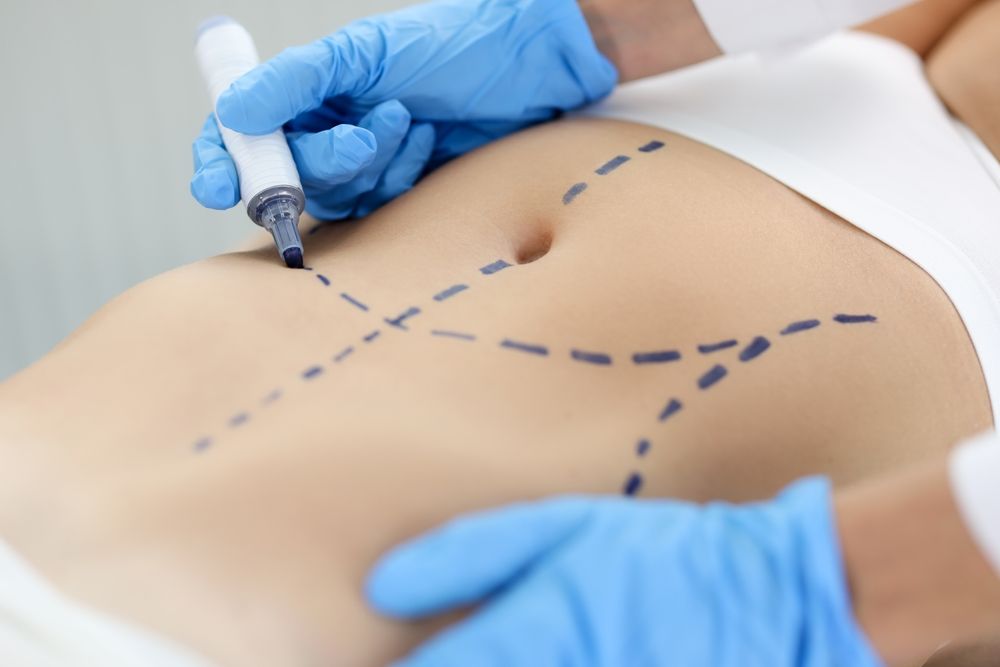 Learn More About Abdominoplasty Paid Trials 2025