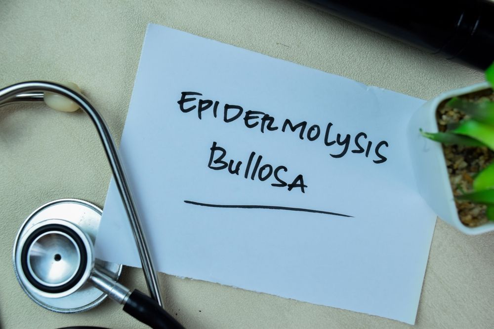 Advances in Epidermolysis Bullosa Treatment 