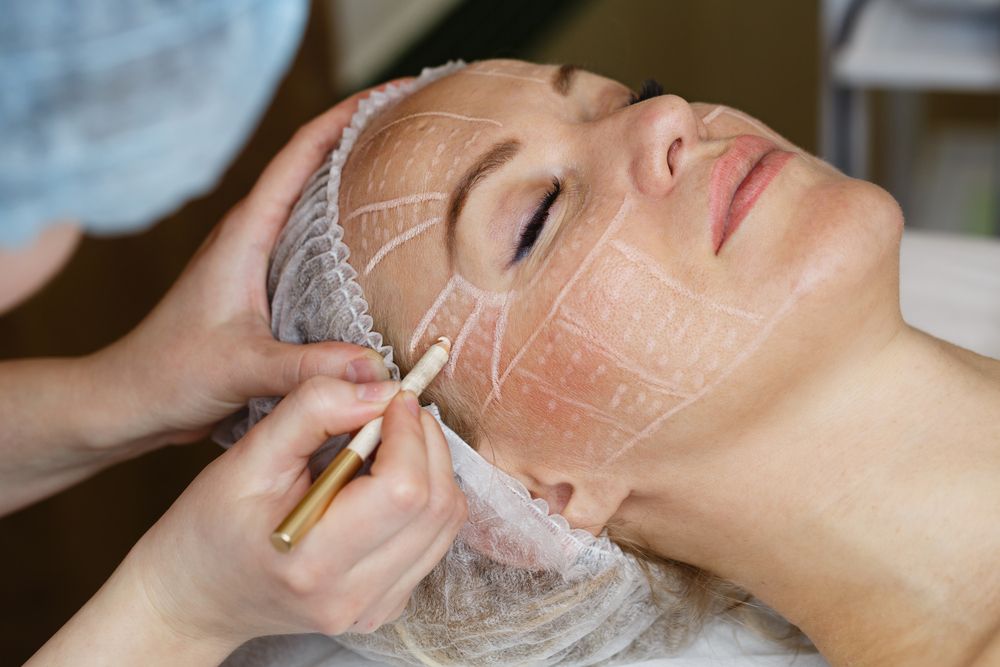 Laser Facelift Cost and What You Get for Your Money