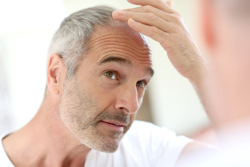 Check Out This “Bold” Leap in Hair-Loss Treatment | Shutterstock