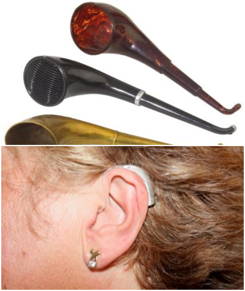 Hearing Aid | Alamy Stock Photo by INTERFOTO/History & Stephen French