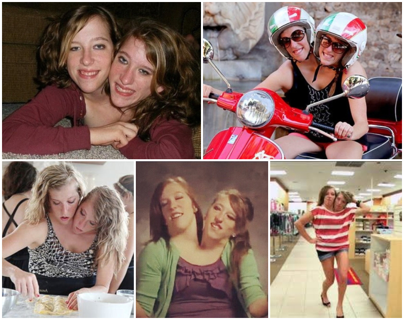 Unidas de por vida: la asombrosa historia de estas gemelas siamesas | Instagram/@abbyandbrittany & Facebook/@Abby-and-Brittany