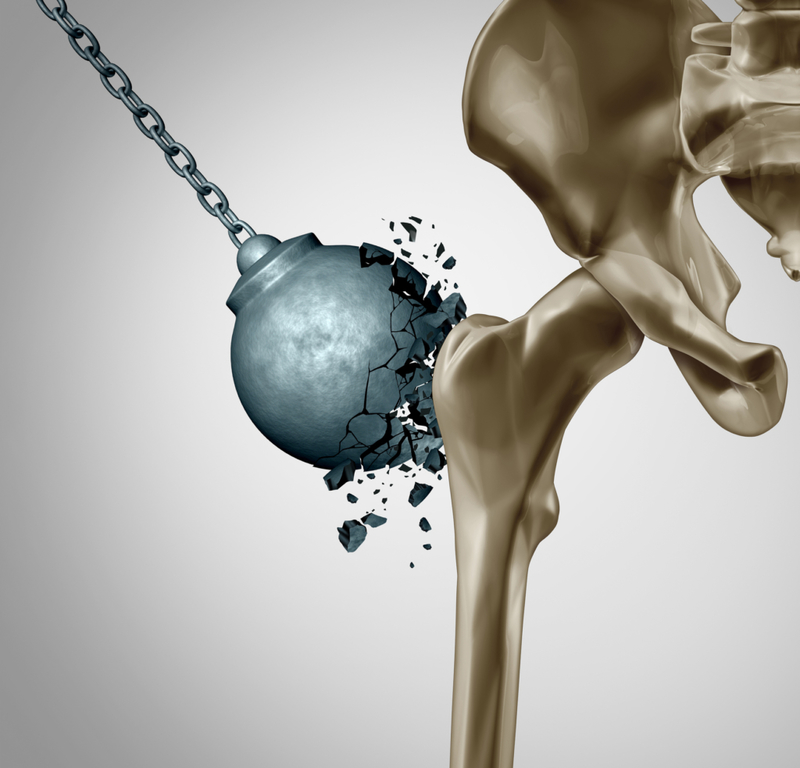 El gen que te da huesos irrompibles | Getty Images Photo by wildpixel