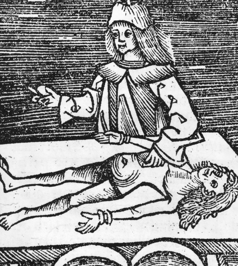 La cirugía medieval solía ser mortal | Getty Images Photo by Hulton Archive