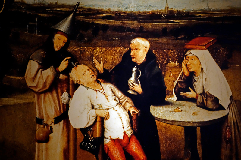 La operación de trepanación: La lobotomía medieval | Alamy Stock Photo