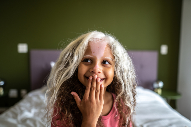 Un mechón de pelo blanco | Getty Images Photo by FG Trade