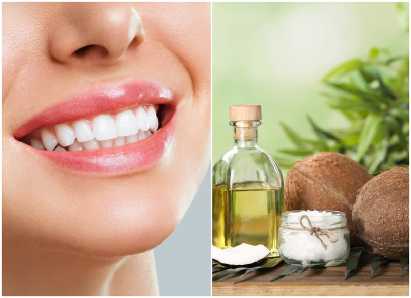 Aceite de coco para unos dientes sanos | Shutterstock