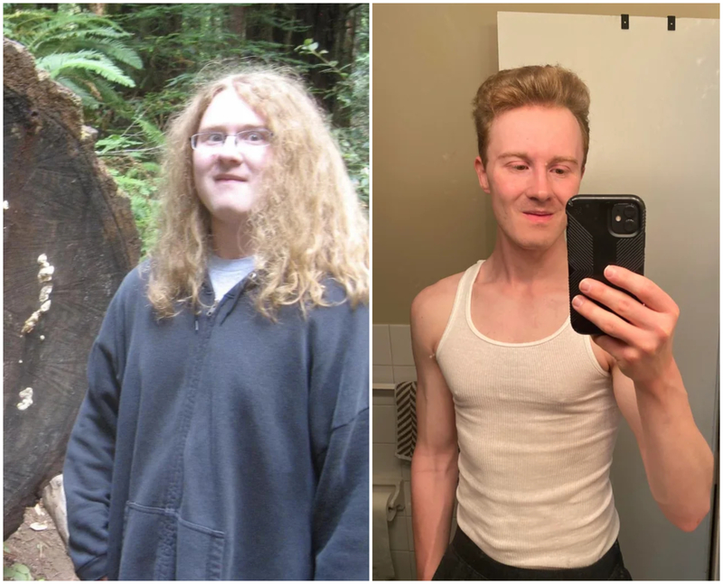 The Hairy Teen Who Turned into a Movie Star | Reddit.com/scoot_da_fut